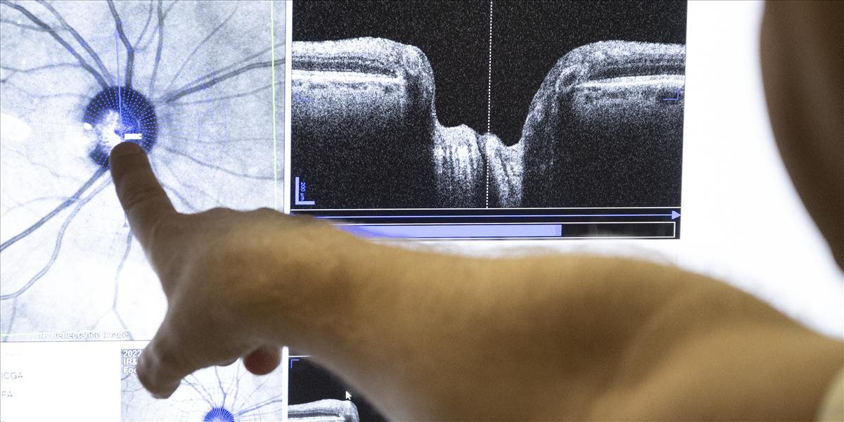 Pacientov so zeleným zákalom v očných ambulanciách pribúda