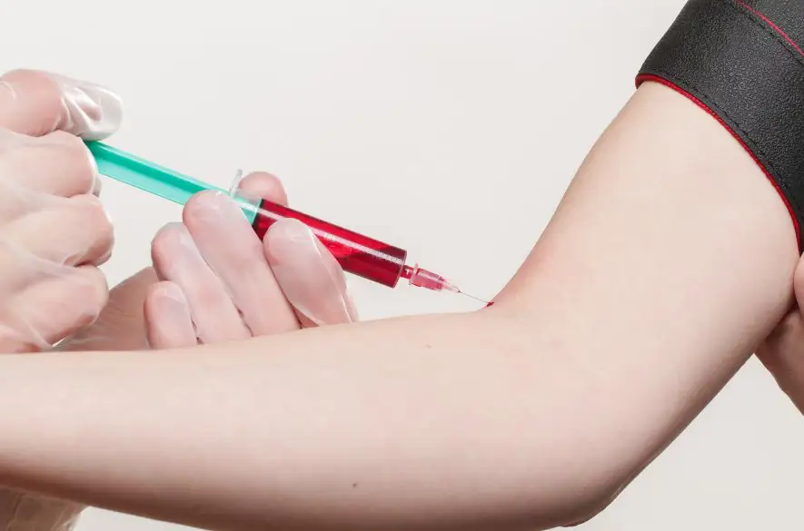 Hygienici evidujú v obci Lesíček v okrese Prešov 28 prípadov žltačky typu A