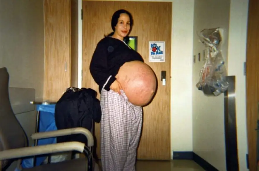 Zaslúžilá matka osmerčiat ukázala po čase, ako dnes vyzerajú a vyrástli jej deti.