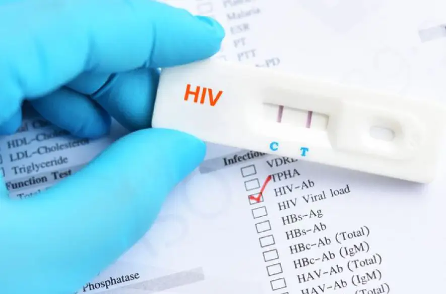 Európsky týždeň testovania 2023: Otestujte sa na HIV