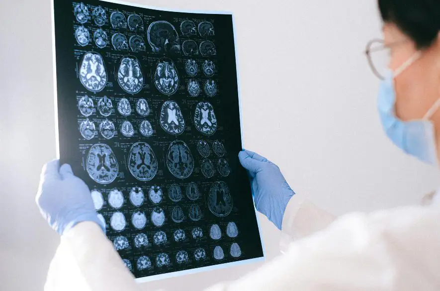 Eurofondy podporili revolučnú aplikáciu na zistenie Alzheimera, je to nádej pre pacientov a ich rodiny