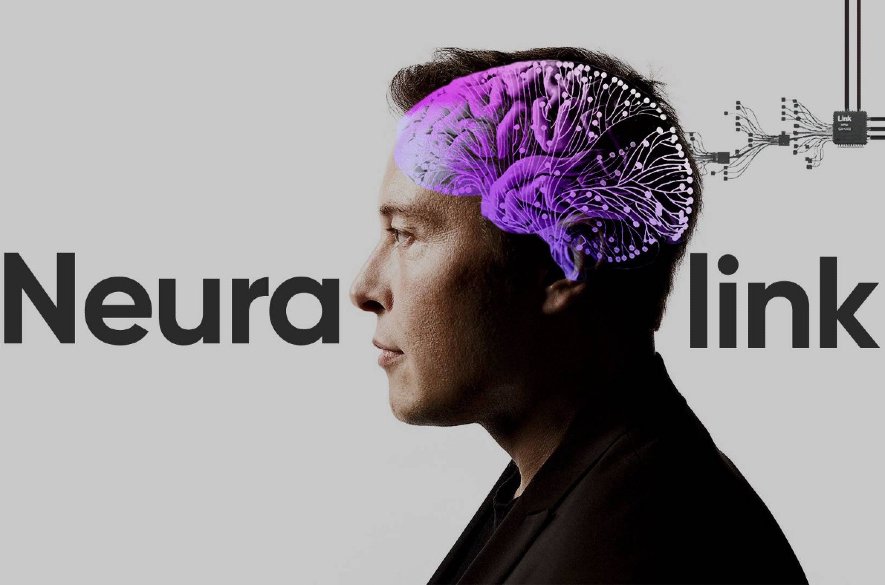 Prvý subjekt s implantátom Neuralink ovláda počítačovú myš pomocou mozgu, tvrdí Elon Musk