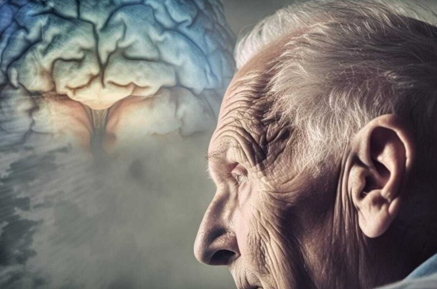 Vedci tvrdia, že našli ďalšiu odlišnú genetickú formu Alzheimerovej choroby