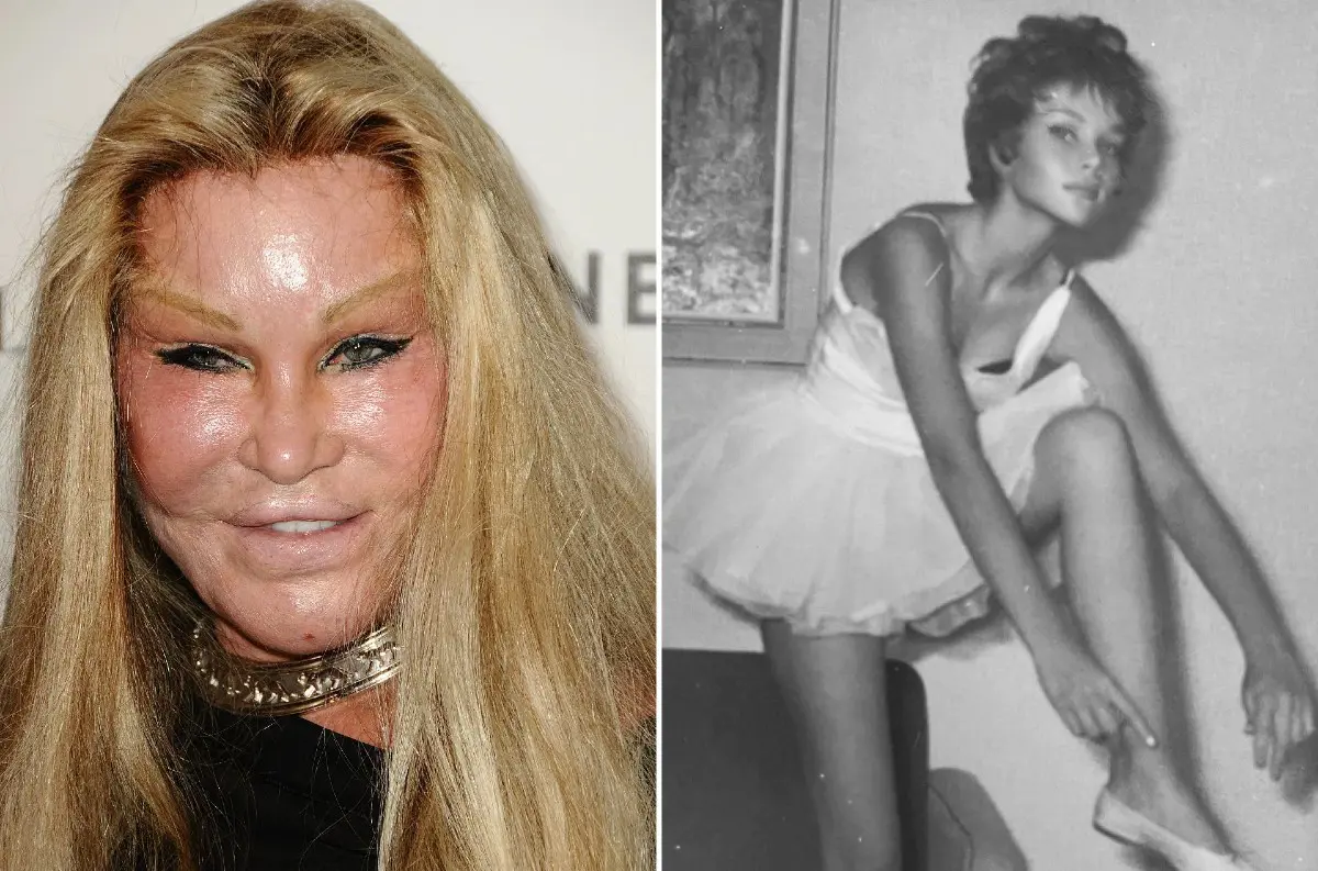 Zomrela „Catwoman“ Jocelyn Wildenstein: Ikona kontroverzných plastických operácií a luxusu