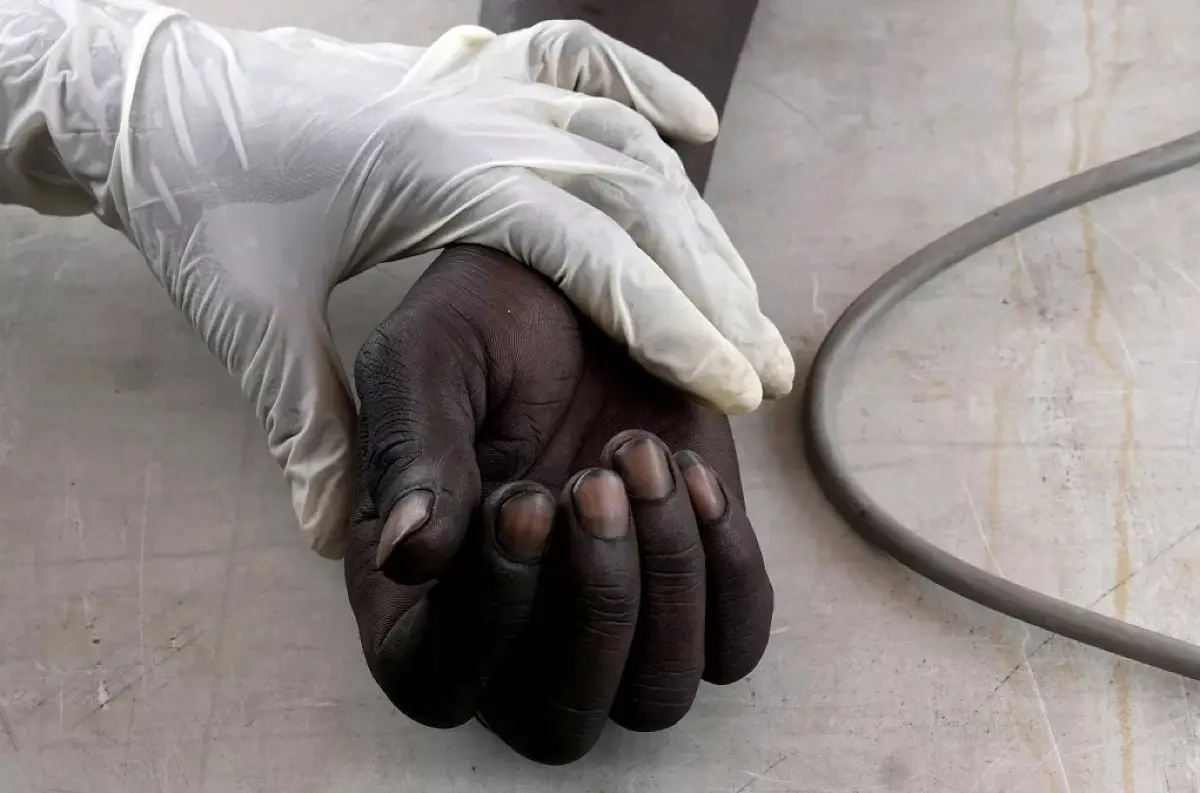 Južná Afrika: Ako Pretória bojuje proti HIV a drogovej závislosti!