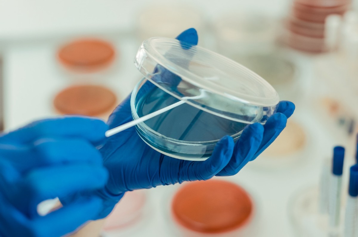 Superbaktéria Candida auris sa šíri USA: Je odolná voči liekom a smrteľná pre zraniteľných