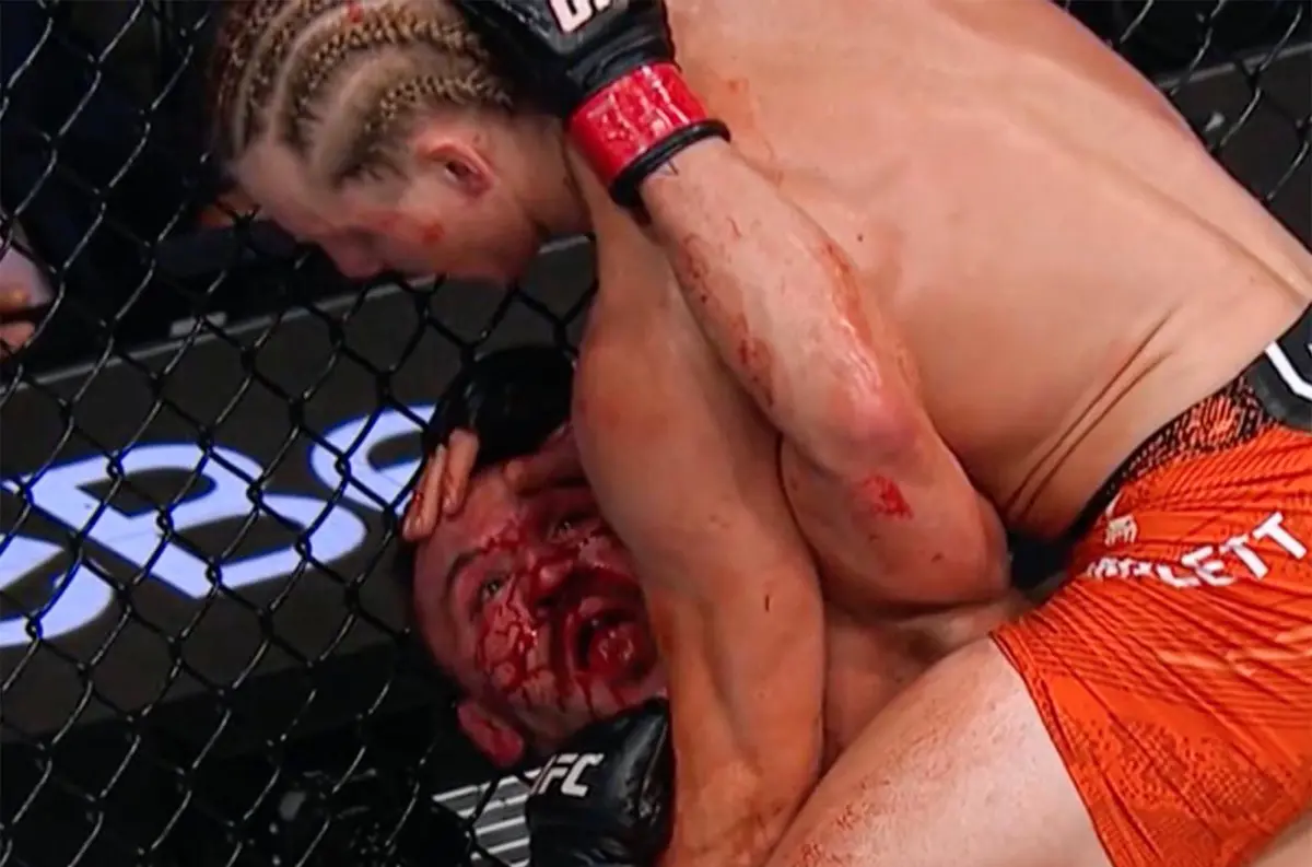 Brutálne koleno a krvavá prehra: Michael Chandler prehovoril po UFC 314 – jeho slová dojali celý svet +VIDEO