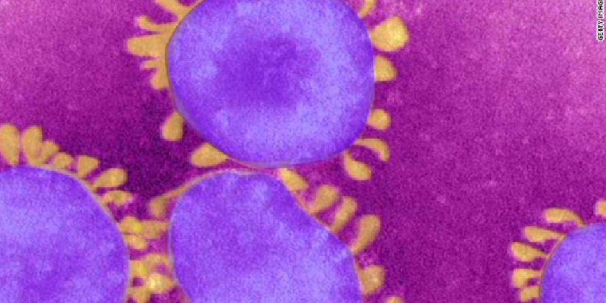 Vo Francúzsku už traja nakazení vírusom podobným SARS