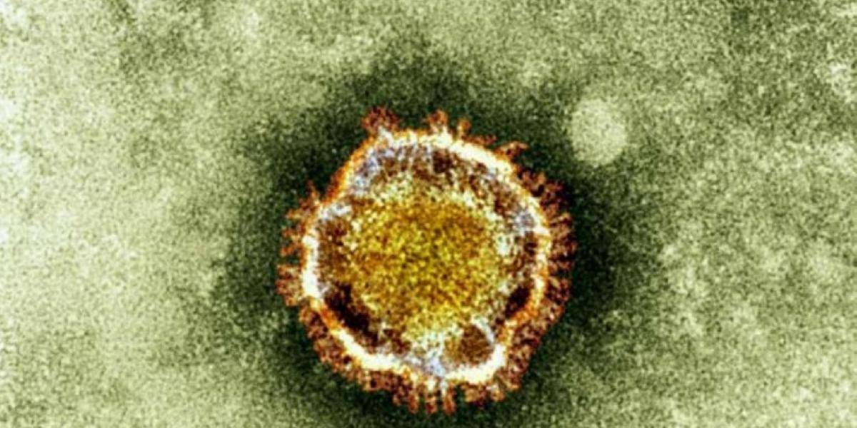 V Saudskej Arábii sa zvýšil počet obetí nového koronavírusu na 28!