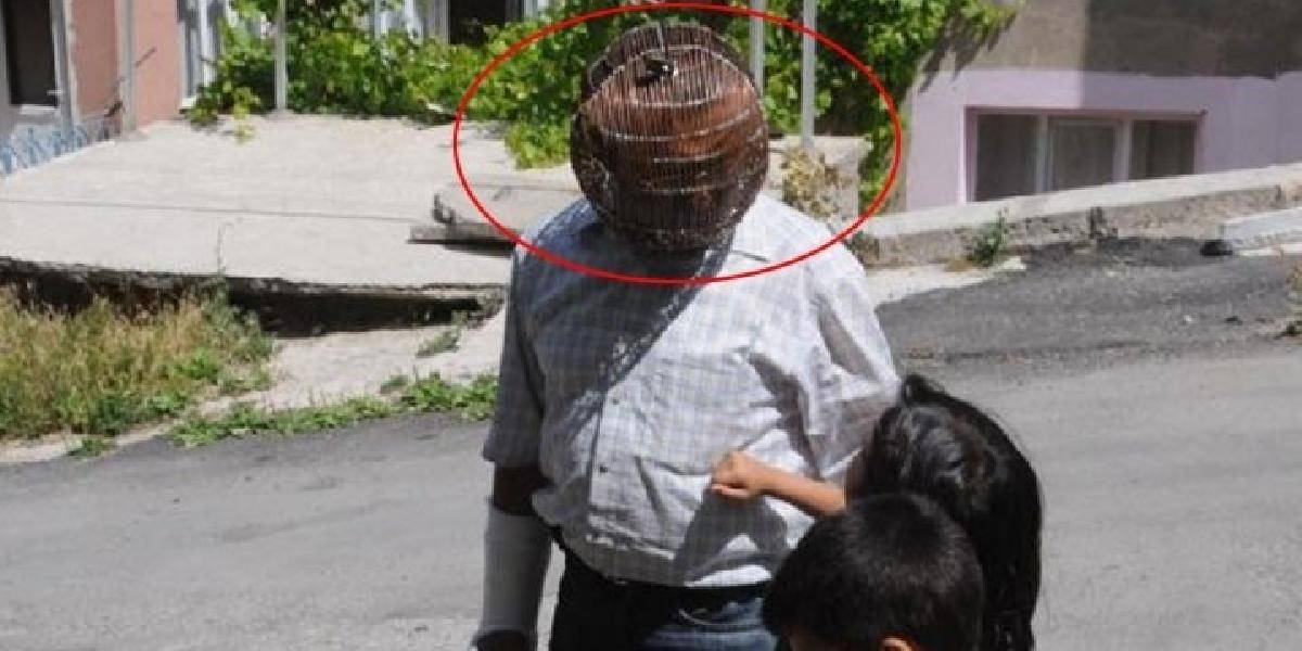 Muž našiel spôsob ako prestať fajčiť: Nosí na hlave klietku!