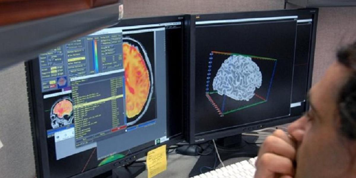 Vedci z STU skúmajú vznik a liečbu Alzheimerovej choroby