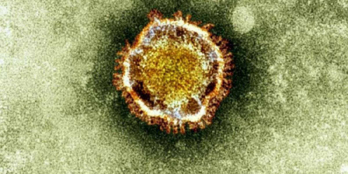 Saudská Arábia hlási novú obeť koronavírusu