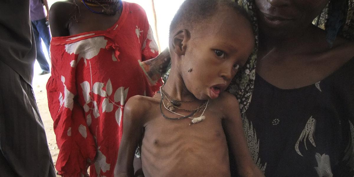 V súčasnosti trpí chronickou podvýživou vyše 870 miliónov ľudí na svete