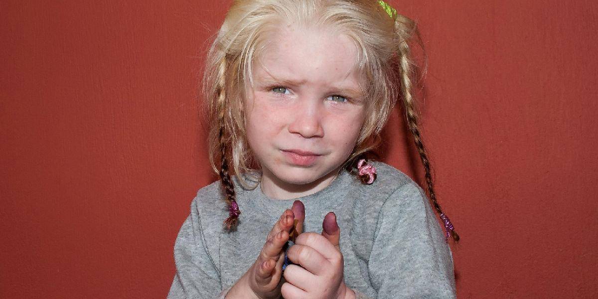 Bulharsko sa postará o sedem súrodencov svetlovlasého dievčatka z Grécka