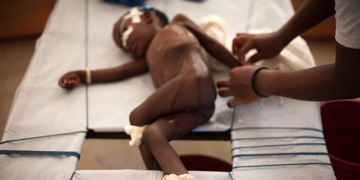Epidémia cholery v Nigérii si vyžiadala už 71 obetí