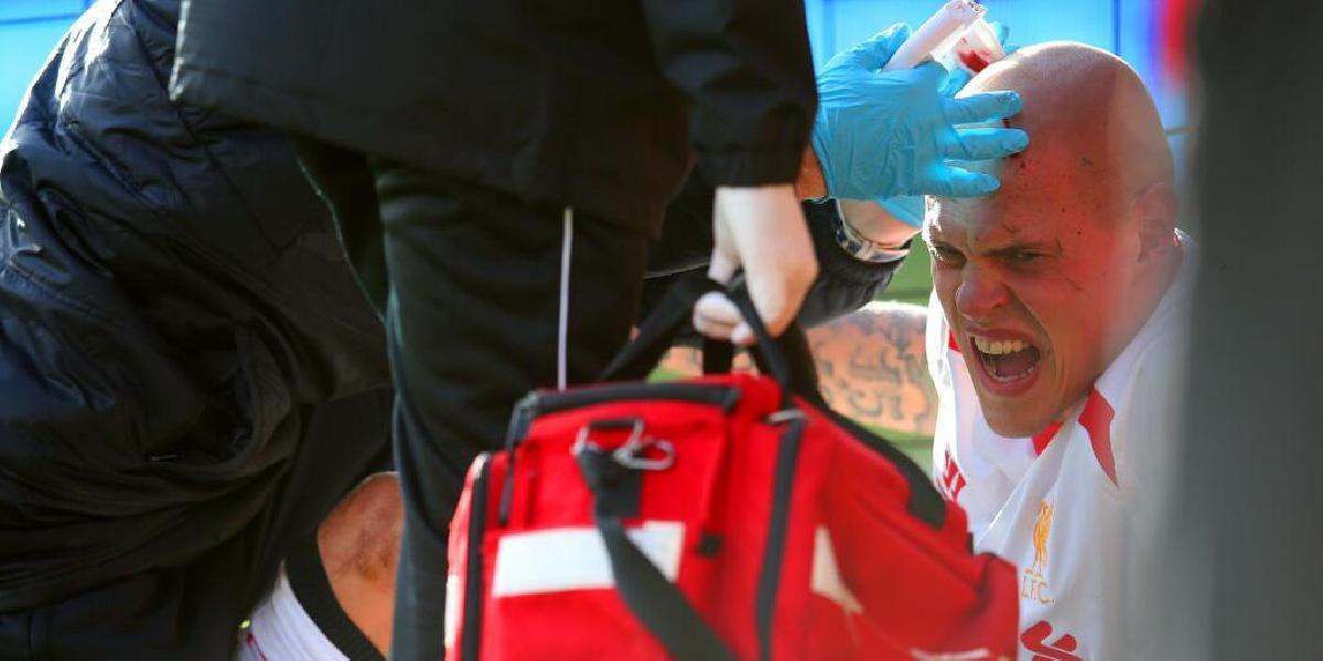 Škrtelovi počas zápasu zašili ranu na hlave zošívačkou